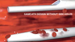 Gamcath design without side holes versus lumen tip with side holes