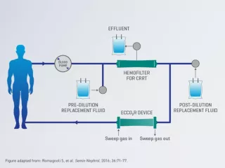 Prismalung diagram