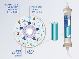 Oxiris filter diagram